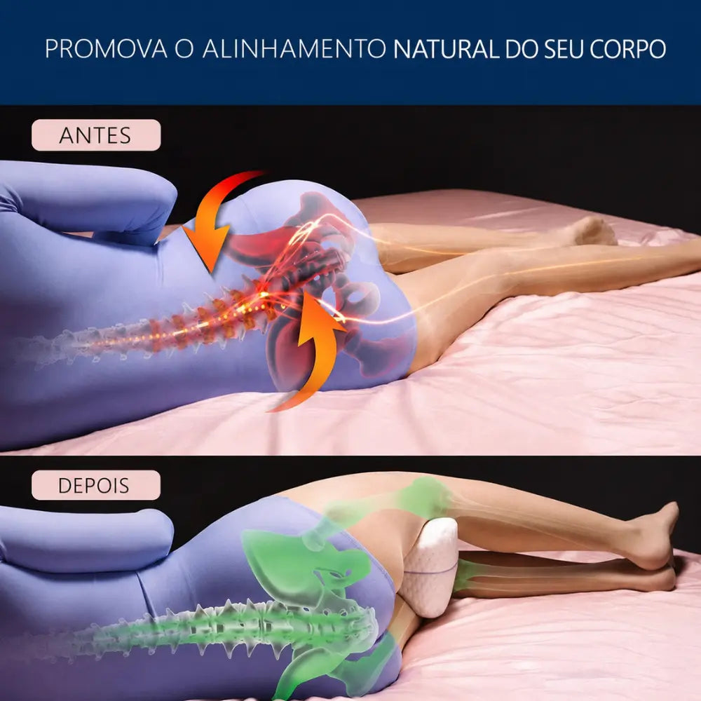 Comparativo mostrando no topo o corpo deitado de lado sem suporte, com a coluna e quadril desalinhados, e abaixo a postura alinhada e equilibrada utilizando o travesseiro ortopédico entre as pernas.
