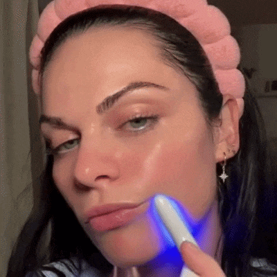 Demonstração do uso da luz LED azul para purificação e equilíbrio da pele na bochecha Loja Morela.
