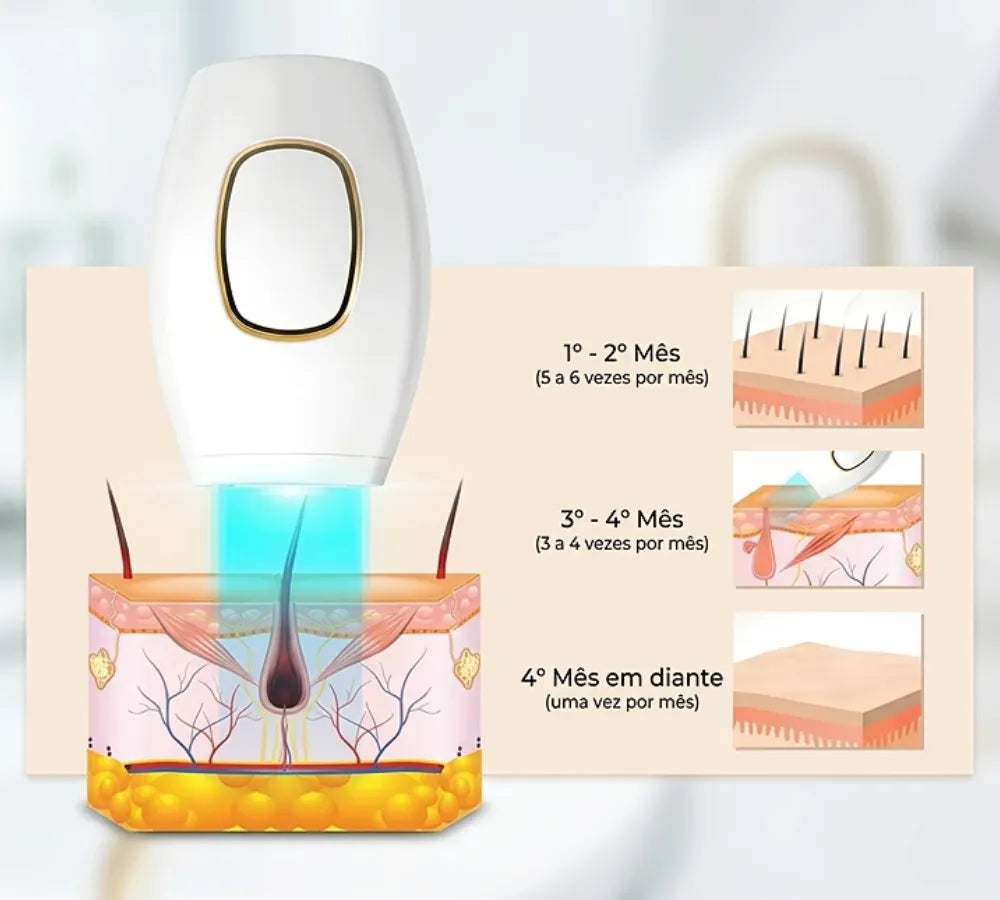 Infográfico explicando a penetração da luz pulsada no folículo para inibir o crescimento do pelo Loja Morela